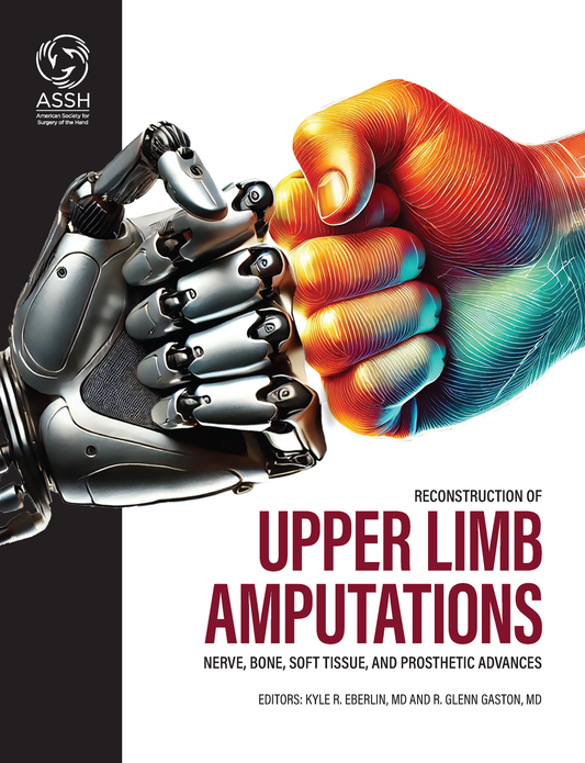 Reconstruction of Upper Limb Amputations